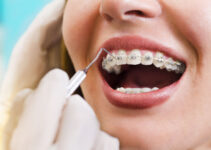 Orthodontics for a Lifetime: Long-Term Benefits and Retention Strategies